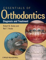 Essentials of Orthodontics Diagnosis and Treatment