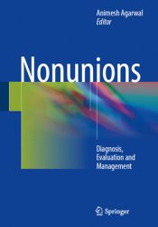 Nonunions: Diagnosis, Evaluation and Management