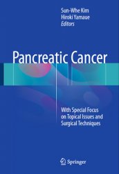 Pancreatic Cancer: With Special Focus on Topical Issues and Surgical Techniques