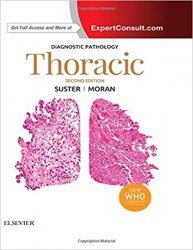 Diagnostic Pathology: Thoracic, 2e