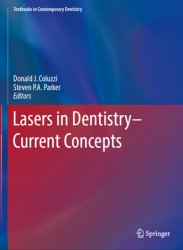Lasers in Dentistry  Current Concepts