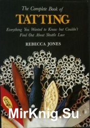 The Complete Book of Tatting
