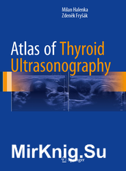 Atlas of Thyroid Ultrasonography