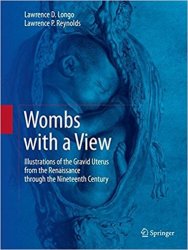 Wombs with a View: Illustrations of the Gravid Uterus from the Renaissance through the Nineteenth Century