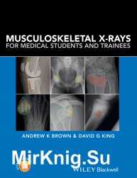 Musculoskeletal X-rays for Medical Students and Trainees