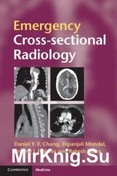 Emergency Cross-Sectional Radiology