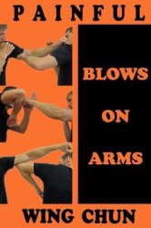 Painful blows on arms
