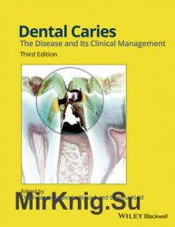 Dental Caries. The Disease and its Clinical Management. 3nd Edition