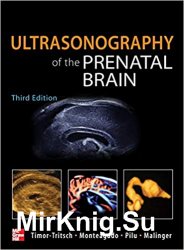 Ultrasonography of the Prenatal Brain. Third Edition