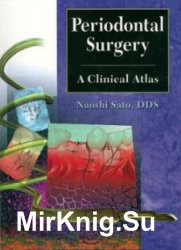 Periodontal Surgery. A Clinical Atlas
