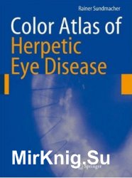 Color Atlas of Herpetic Eye Disease: A Practical Guide to Clinical Management