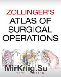 Zollingers Atlas of Surgical Operations