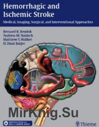Hemorrhagic and Ischemic Stroke. Medical, Imaging, Surgical, and Interventional Approaches