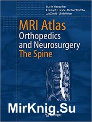 MRI Atlas: Orthopedics and Neurosurgery, The Spine