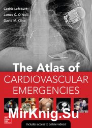 Atlas Of Cardiovascular Emergencies