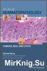 Atlas of Dermatopathology: Tumors, Nevi, and Cysts