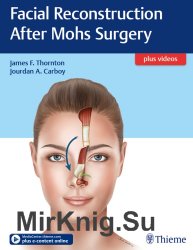 Facial Reconstruction After Mohs Surgery