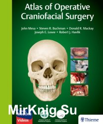 Atlas of Operative Craniofacial Surgery