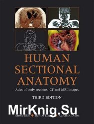 Human Sectional Anatomy: Pocket Atlas of Body Sections, CT and MRI Images