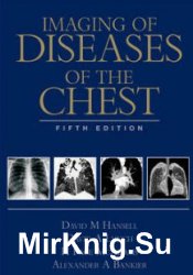 Imaging of Diseases of the Chest