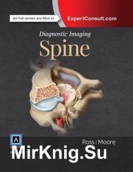 Diagnostic imaging Spine