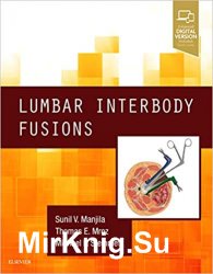 Lumbar Interbody Fusions