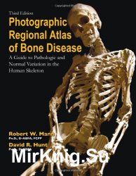 Photographic Regional Atlas of Bone Disease: A Guide to Pathologic and Normal Variations in the Human Skeleton