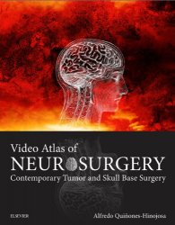 Video Atlas of Neurosurgery: Contemporary Tumor and Skull Base Surgery