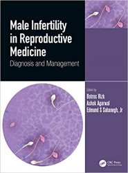 Male Infertility in Reproductive Medicine : Diagnosis and Management