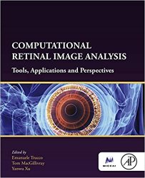 Computational Retinal Image Analysis: Tools, Applications and Perspectives