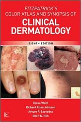 Fitzpatrick's Color Atlas and Synopsis of Clinical Dermatology, 8th Edition
