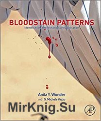 Bloodstain Patterns. Identification, Interpretation and Application