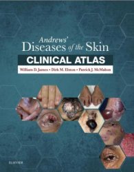 Andrews Diseases of the Skin Clinical Atlas