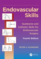 Endovascular Skills: Guidewire and Catheter Skills for Endovascular Surgery, 4th Edition