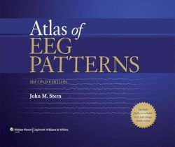 An Atlas of EEG Patterns